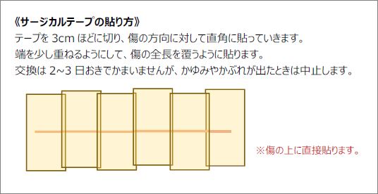 テープの貼り方